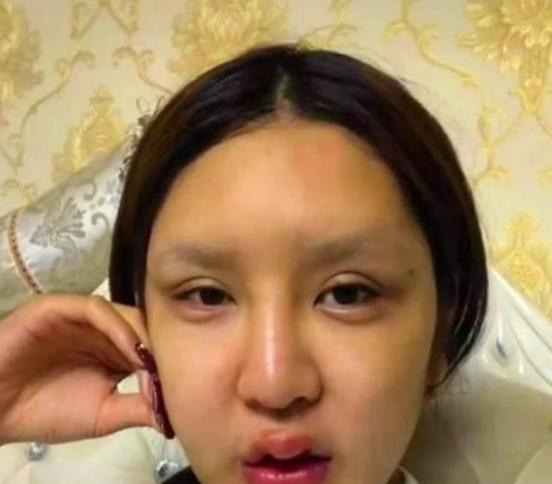 小网红整容,揭秘网红整形之路