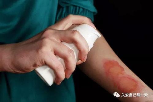 被烫伤敢吃凉瓜吗贴吧,贴吧热议健康饮食之道