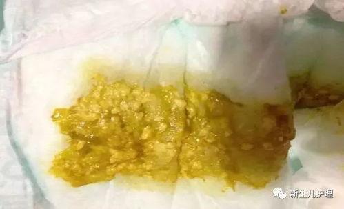 喝了牛奶吃哈密瓜拉肚子,小心肠胃不适
